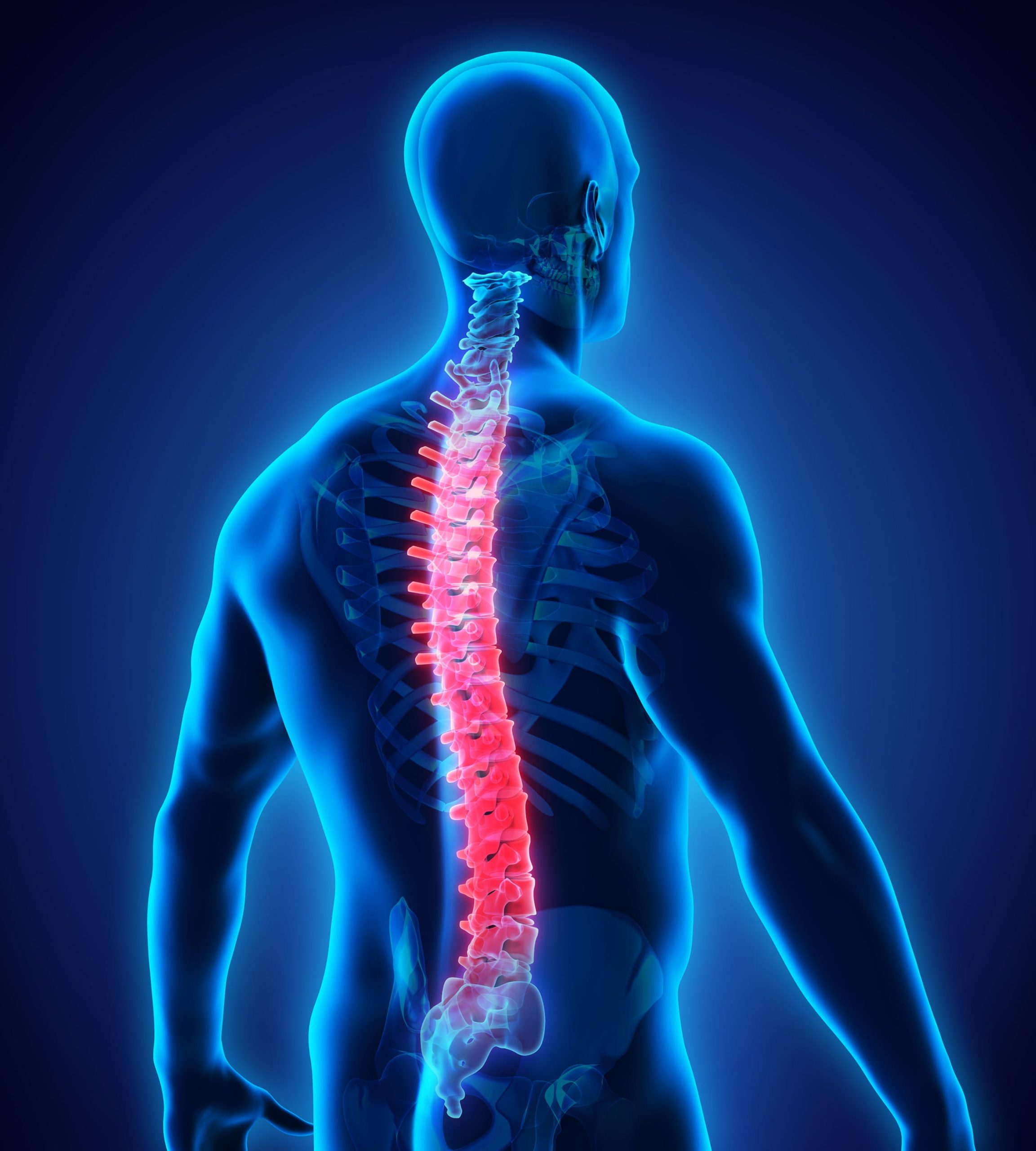 back-spinal-injuries-personal-law-btmk-solicitors